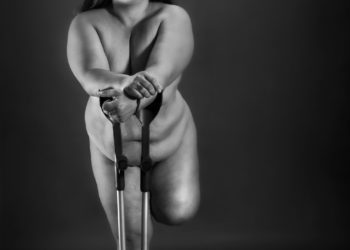 Muestra fotográfica «Cicatrices de mujer chilena» llega a Viña del Mar