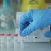 Presentan proyecto para limitar la rentabilidad de clínicas por exámenes de detección del coronavirus