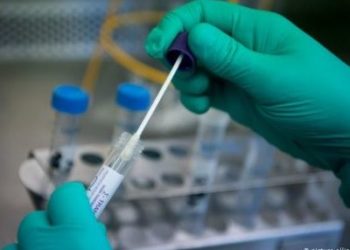 Senadores piden al Gobierno que exámenes de detección del Covid-19 sean gratuitos