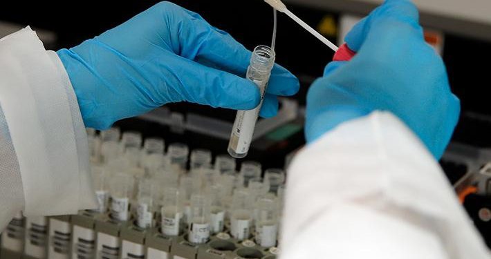 Ofician al intendente, seremi de Salud y jefe de Defensa Nacional de Valparaíso para pedir mayor número de test PCR y cuarentena total por el Covid-19