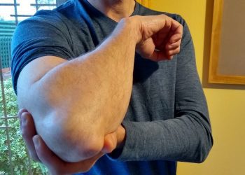 Lesiones relacionadas con el trabajo de escritorio son las más frecuentes durante el confinamiento