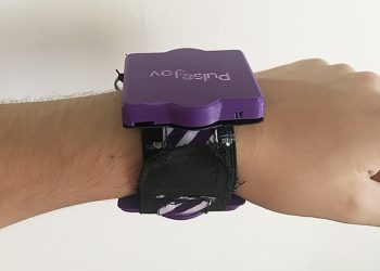 Pulsera inteligente que alerta sobre crisis epilépticas es creada por ingeniero de la UPLA