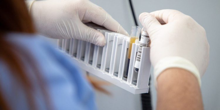 Ya está abierta la sala de muestra del Laboratorio Clínico Popular de Valparaíso