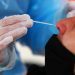 Infectólogo advierte que la reinfección por COVID-19 puede complicar aún más el manejo y control de la pandemia