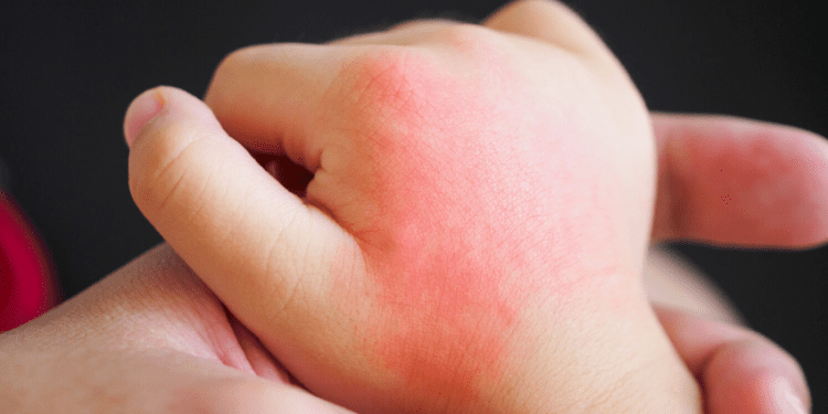 PIMS: ¿A qué aspectos se debe prestar atención en niños y niñas?