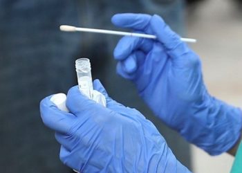 COVID-19: positividad en la región alcanza nuevo peak de 18%