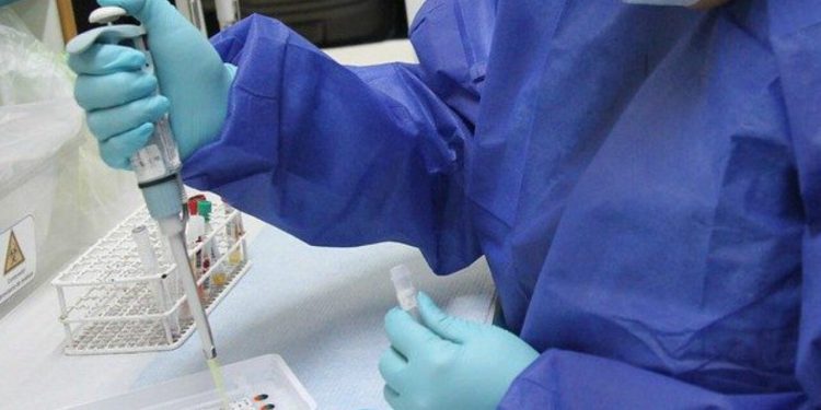 Pese a cuarentenas, alta positividad y subdiagnóstico de casos demuestran que la pandemia no da tregua