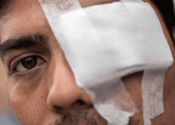 Por críticas al programa de reparación ocular PIRO, Comisión de Derechos Humanos del Senado recibirá a ministros