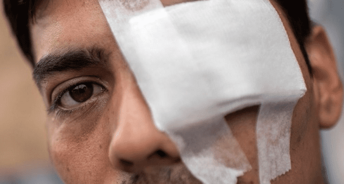 Por críticas al programa de reparación ocular PIRO, Comisión de Derechos Humanos del Senado recibirá a ministros