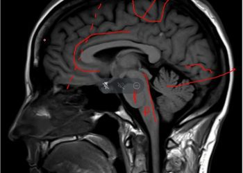Cerca de 200 profesionales de 32 comunas del Programa Previene de SENDA son capacitados en la UPLA