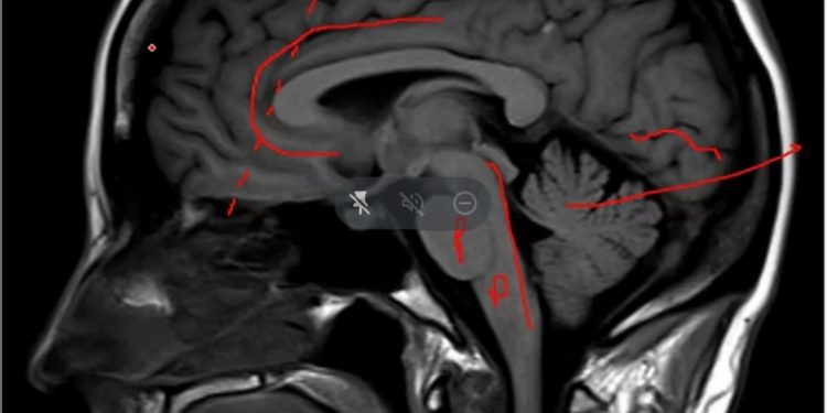 Cerca de 200 profesionales de 32 comunas del Programa Previene de SENDA son capacitados en la UPLA