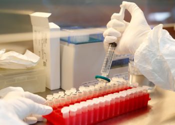 Llegada de Delta a Chile: las diferencias entre variable de interés y variable de preocupación según la clasificación de la OMS