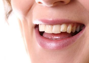 Columna de opinión / Vergüenza silenciosa: La salud bucal en Chile