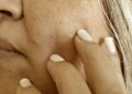 Kinesiólogo maxilofacial de la UPLA advierte sobre las complejas consecuencias del bruxismo