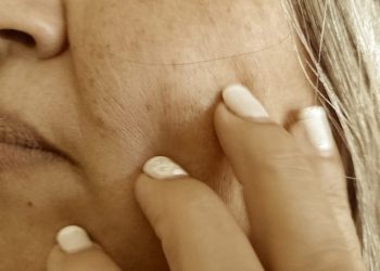 Kinesiólogo maxilofacial de la UPLA advierte sobre las complejas consecuencias del bruxismo