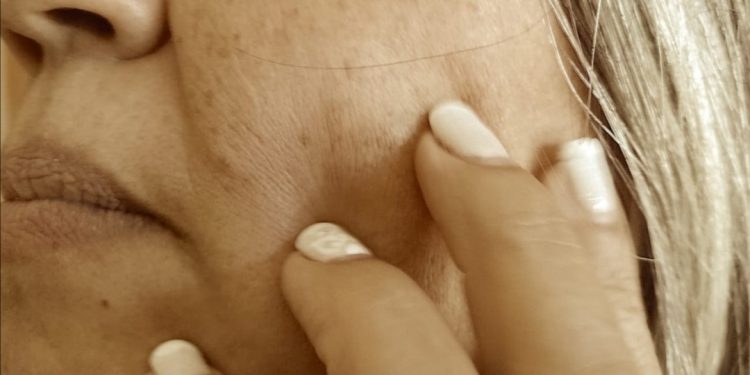 Kinesiólogo maxilofacial de la UPLA advierte sobre las complejas consecuencias del bruxismo