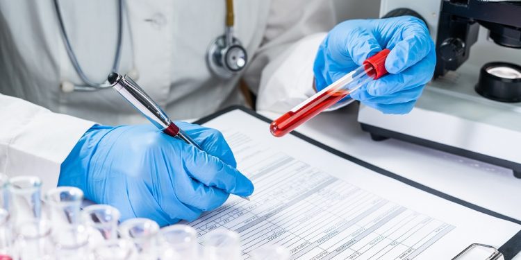 Entrevista / Daniela Araneda, académica y experta en salud pública: «El VIH es otra pandemia y quedó invisibilizada por el coronavirus»