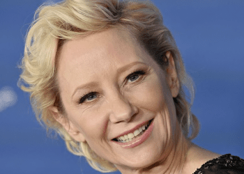 Actriz Anne Heche sufre graves quemaduras tras accidente automovilístico