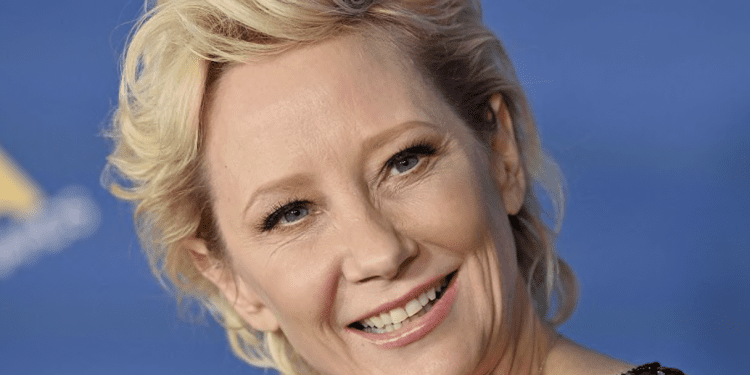 Actriz Anne Heche sufre graves quemaduras tras accidente automovilístico