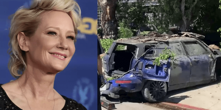 Actriz Anne Heche está en coma y familiares piden que recen por ella