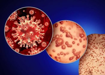 Minsal anuncia vacuna contra viruela del mono y que los primeros en recibirla serán contactos estrechos y grupos de riesgo