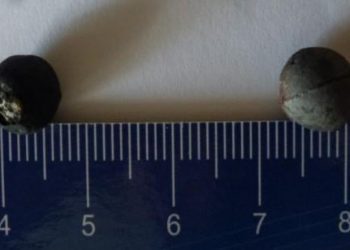 Villa Alemana: Niño recibe impacto de perdigón desde un automóvil