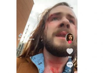 Puerto Varas: Turista es golpeado después de conocer a joven por aplicación