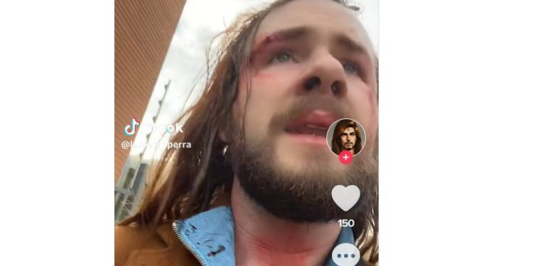 Puerto Varas: Turista es golpeado después de conocer a joven por aplicación