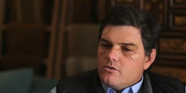Alcalde de Zapallar tras violento asalto: «La saqué barata»