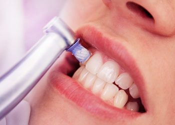5 consejos para evitar la aparición de sarro en los dientes