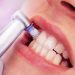 5 consejos para evitar la aparición de sarro en los dientes