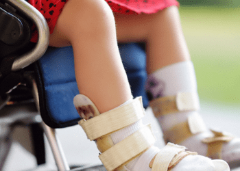 Investigadores chilenos buscan implementar innovadora terapia para niños con parálisis cerebral