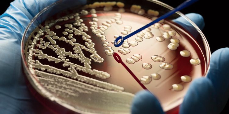 Expertos advierten que la resistencia a los antimicrobianos podría ser la próxima pandemia mundial