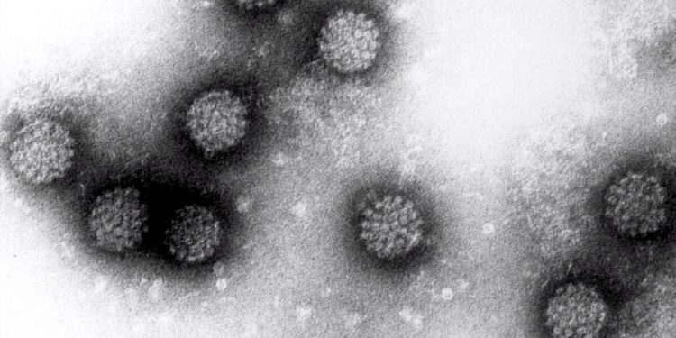 Bupa Lab lanza tecnología única en Chile y Latinoamérica para identificar el Virus del Papiloma Humano con examen de orina