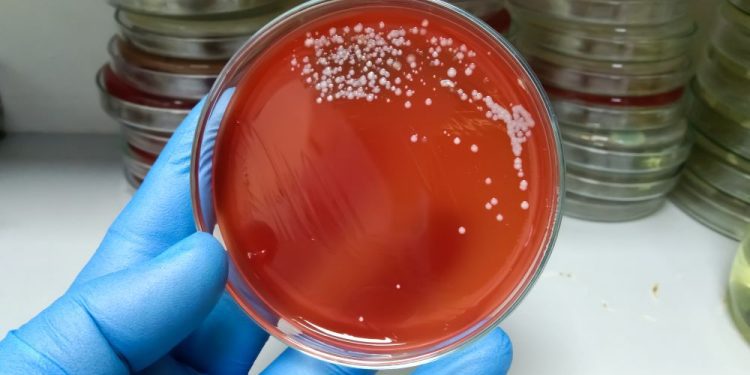 Temprana detección de la “bacteria asesina” es crucial para evitar complicaciones