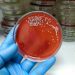 Temprana detección de la “bacteria asesina” es crucial para evitar complicaciones