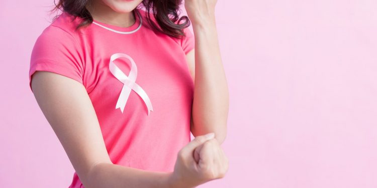 Cáncer de mama: la vida después del tratamiento