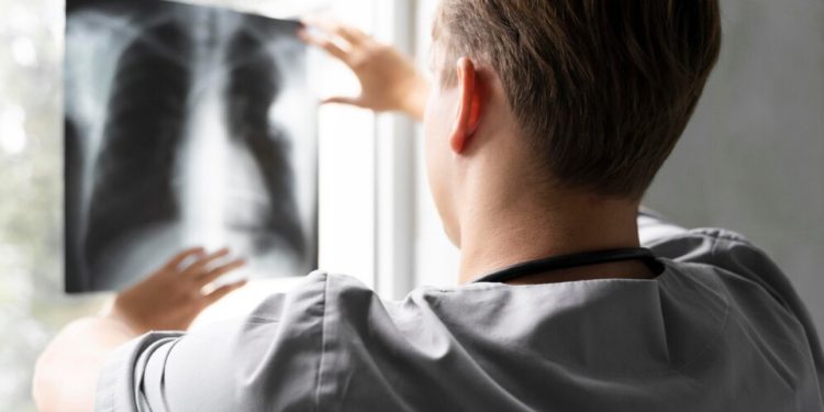 Cáncer de pulmón es el más letal en Chile y provoca 4 mil muertes cada año