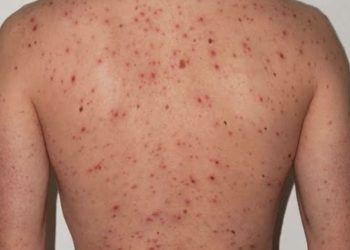 Presupuesto 2026 y personas mayores